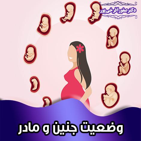 وضعیت جنین و مادر