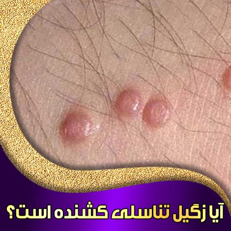 راهکار برای درد واکسن گارداسیل +واکسن HPV از کجا بخرم+ویروسHPVکشنده است