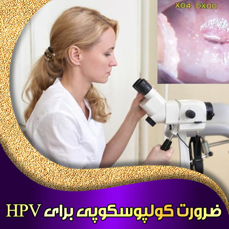 ضرورت کولپوسکوپی برای HPV