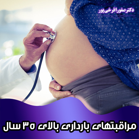مراقبتهای بارداری بالای 35 سال