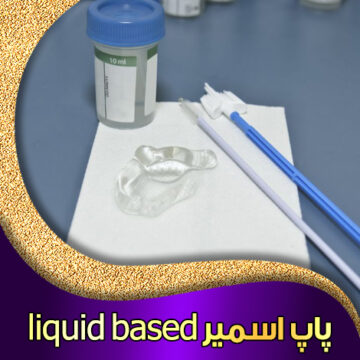 پاپ-اسمیر-liquid-based